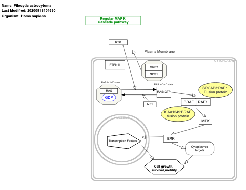 Pilocytic astrocytoma